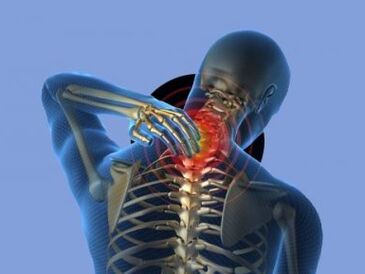 A person with osteochondrosis of the cervical spine is worried about neck pain